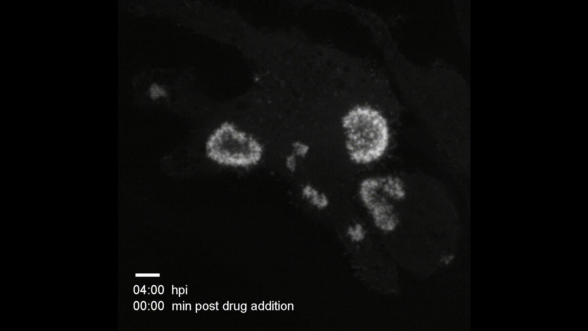 Baculovirus invadosome dynamics